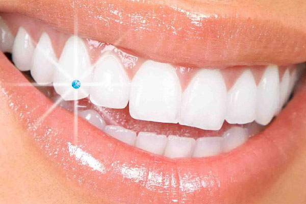 Tooth-Jewellery-solapur